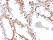 IHC staining of FFPE human prostate with SOD1 antibody. HIER: boil tissue sections in pH 9 10mM Tris with 1mM EDTA for 20 min and allow to cool before testing.