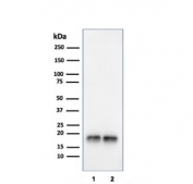 Western blot testing of human 1) JEG-3 and 2) LNCaP cell lysate with SOD1 antibody. Predicted molecular weight ~16 kDa.