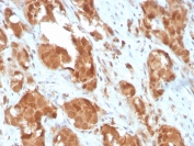 IHC staining of FFPE human prostate with SOD1 antibody. HIER: boil tissue sections in pH 9 10mM Tris with 1mM EDTA for 20 min and allow to cool before testing.