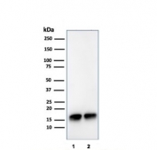 Western blot testing of human 1) JEG-3 and 2) LNCaP cell lysate with SOD1 antibody. Predicted molecular weight ~16 kDa.