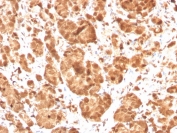 IHC staining of FFPE human tonsil with SOD1 antibody. HIER: boil tissue sections in pH 9 10mM Tris with 1mM EDTA for 20 min and allow to cool before testing.