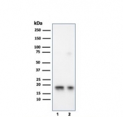 Western blot testing of human 1) JEG-3 and 2) LNCaP cell lysate with SOD1 antibody. Predicted molecular weight ~16 kDa.