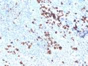 IHC staining of FFPE human tonsil with SOD1 antibody. HIER: boil tissue sections in pH 9 10mM Tris with 1mM EDTA for 20 min and allow to cool before testing.