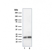 Western blot testing of human 1) JEG3 and 2) LNCaP lysate with SOD1 antibody. Predicted molecular weight ~16 kDa.