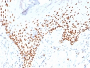 IHC staining of FFPE human skin with recombinant p40 antibody (clone rTP40/3690). HIER: boil tissue sections in pH 9 10mM Tris with 1mM EDTA for 20 min and allow to cool before testing.