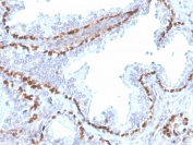 IHC staining of FFPE human kidney with recombinant p40 antibody (clone rTP40/3690). HIER: boil tissue sections in pH 9 10mM Tris with 1mM EDTA for 20 min and allow to cool before testing.