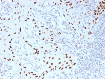 IHC staining of FFPE human skin with recombinant p40 antibody (clone TP40/3980R). HIER: boil tissue sections in pH 9 10mM Tris with 1mM EDTA for 20 min and allow to cool before testing.