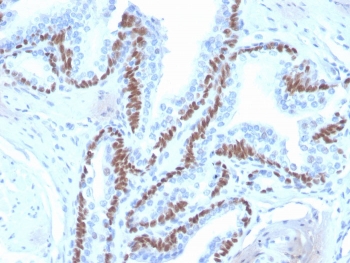IHC staining of FFPE human skin with deltaNp63 antibody (clone ZR8). HIER: boil tissue sections in pH 9 10mM Tris with 1mM EDTA for 20 min and allow to cool before testing.