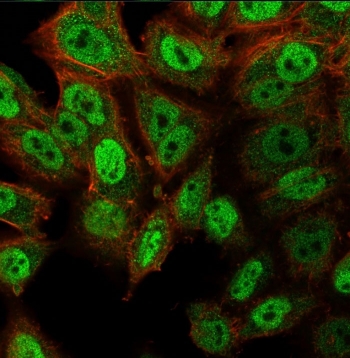 Immunofluorescent staining of PFA-fixed human HeLa cells with deltaNp63 antibody (clone ZR8, green) and Phalloidin (red).
