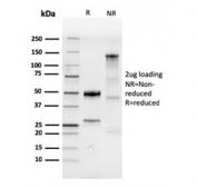 SDS-PAGE analysis of purified, BSA-free recombinant CDX2 antibody as confirmation of integrity and purity.