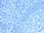 Negative control: IHC analysis of CDX2 / Caudal type homeobox 2 antibody in human tonsil tissue. Formalin-fixed, paraffin-embedded human tonsil shows absence of nuclear HRP-DAB brown chromogenic staining in lymphoid cells, consistent with lack of CDX2 expression in non-intestinal tissue. This section serves as a negative tissue control using clone CDX2/4394R at 2 ug/ml in PBS for 30 min at RT. Heat-induced epitope retrieval was performed by boiling tissue sections in 10mM Tris with 1mM EDTA, pH 9.0, for 45 min at 95oC followed by cooling at RT for 20 minutes.