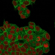 Immunofluorescent staining of PFA-fixed human MCF7 cells with HER2 antibody (clone ZR5, green) and Phalloidin (red).