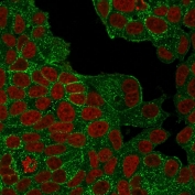 Immunofluorescent staining of PFA-fixed human MCF7 cells with HER2 antibody (clone ERBB2/4439R, green) and Phalloidin (red).