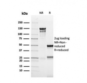SDS-PAGE analysis of purified, BSA-free recombinant MSH6 antibody (clone rMSH6/4743) as confirmation of integrity and purity.