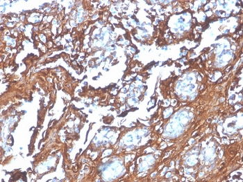IHC staining of FFPE human tonsil with recombinant Annexin A1 antibody (clone rANXA1/4310). HIER: boil tissue sections in pH 9 10mM Tris with 1mM EDTA for 20 min and allow to cool before testing.~