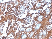 IHC staining of FFPE human tonsil with recombinant Annexin A1 antibody (clone rANXA1/4310). HIER: boil tissue sections in pH 9 10mM Tris with 1mM EDTA for 20 min and allow to cool before testing.