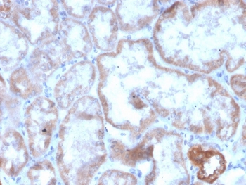 IHC staining of FFPE human kidney with recombinant CD137 antibody (clone r4-1BB/4603). HIER: boil tissue sections in pH 9 10mM Tris with 1mM EDTA for 20 min and allow to cool before testing.~