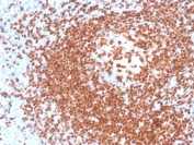 IHC staining of FFPE human tonsil with recombinant PAX5 antibody. HIER: boil tissue sections in pH 9 10mM Tris with 1mM EDTA for 20 min and allow to cool before testing.