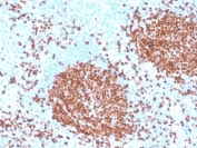 IHC staining of FFPE human tonsil with recombinant PAX5 antibody. HIER: boil tissue sections in pH 9 10mM Tris with 1mM EDTA for 20 min and allow to cool before testing.