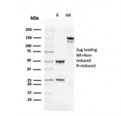 SDS-PAGE analysis of purified, BSA-free recombinant dsDNA antibody (clone rDSD/4565) as confirmation of integrity and purity.