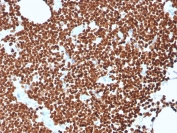 IHC staining of FFPE human lymph node with recombinant dsDNA antibody (clone rDSD/4565). HIER: boil tissue sections in pH 9 10mM Tris with 1mM EDTA for 20 min and allow to cool before testing.