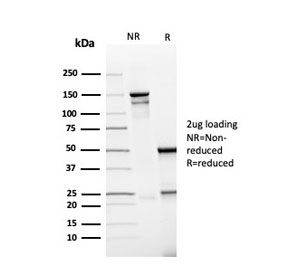 SDS-PAGE analysis of purified, BSA-free recombinant PDL1 antibody (clone rPDL1/4773) as confirmation of integrity and purity.