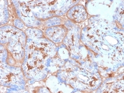 IHC staining of FFPE human placenta with recombinant PDL1 antibody (clone rPDL1/4773). HIER: boil tissue sections in pH 9 10mM Tris with 1mM EDTA for 20 min and allow to cool before testing.