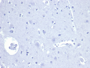 Recombinant AMACR Antibody Human Brain Negative Control IHC. Immunohistochemistry analysis of formalin-fixed, paraffin-embedded human brain tissue using recombinant AMACR Antibody / Alpha-methylacyl-CoA racemase Antibody clone rAMACR/4674 demonstrates minimal background staining, consistent with the low expected expression of AMACR in normal brain tissue. The absence of significant HRP-DAB brown signal supports staining specificity relative to strongly positive carcinoma tissues. HIER: Tris/EDTA, pH9.0, 45 min. Secondary detection: HRP-polymer, 30 min. DAB development: 5 min.