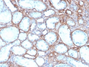 IHC staining of FFPE human kidney with recombinant COL4A antibody. HIER: boil tissue sections in pH 9 10mM Tris with 1mM EDTA for 20 min and allow to cool before testing.