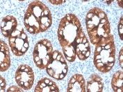 IHC staining of FFPE human colon with recombinant Cytokeratin 8 antibody (clone rKRT8/4209). HIER: boil tissue sections in pH 9 10mM Tris with 1mM EDTA for 20 min and allow to cool before testing.