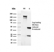 SDS-PAGE analysis of purified, BSA-free recombinant EpCAM antibody (clone rEGP40/4547) as confirmation of integrity and purity.