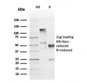 SDS-PAGE analysis of purified, BSA-free recombinant Cyclin D1 antibody (clone CCND1/3370R) as confirmation of integrity and purity.