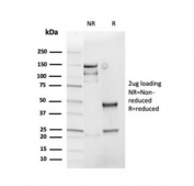 SDS-PAGE analysis of purified, BSA-free recombinant Cyclin D1 antibody (clone rCCND1/4752) as confirmation of integrity and purity.