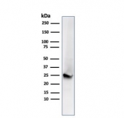 Western blot testing of human brain lysate with recombinant PGP9.5 antibody. Predicted molecular weight ~25 kDa.