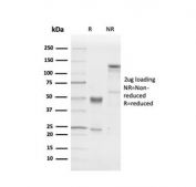 SDS-PAGE analysis of purified, BSA-free recombinant PGP9.5 antibody (clone UCHL1/4556R) as confirmation of integrity and purity.
