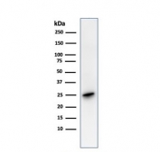 Western blot testing of human brain lysate with recombinant PGP9.5 antibody. Predicted molecular weight ~25 kDa.