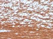 IHC staining of FFPE human cerebellum with recombinant PGP9.5 antibody (clone rUCHL1/4557). HIER: boil tissue sections in pH 9 10mM Tris with 1mM EDTA for 20 min and allow to cool before testing.