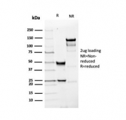 SDS-PAGE analysis of purified, BSA-free recombinant PGP9.5 antibody (clone rUCHL1/4557) as confirmation of integrity and purity.