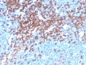 IHC staining of FFPE human lymph node with recombinant CD4 antibody. HIER: boil tissue sections in pH 9 10mM Tris with 1mM EDTA for 20 min and allow to cool before testing.