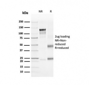 SDS-PAGE analysis of purified, BSA-free recombinant CD4 antibody as confirmation of integrity and purity.