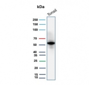 Western blot testing of human tonsil tissue with recombinant CD4 antibody. Expected molecular weight: 50-55 kDa.