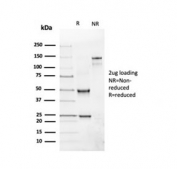 SDS-PAGE analysis of purified, BSA-free recombinant CD19 antibody as confirmation of integrity and purity.