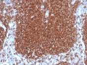 IHC staining of FFPE human lymph node with recombinant CD19 antibody. HIER: boil tissue sections in pH 9 10mM Tris with 1mM EDTA for 20 min and allow to cool before testing.