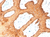 IHC staining of FFPE human skin with recombinant Type II Cytokeratin antibody (clone KRTH/4392R). HIER: boil tissue sections in pH 9 10mM Tris with 1mM EDTA for 20 min and allow to cool before testing.