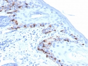 IHC staining of FFPE human skin with recombinant Melan-A antibody (clone rMLANA/4576). HIER: boil tissue sections in pH 9 10mM Tris with 1mM EDTA for 20 min and allow to cool before testing.