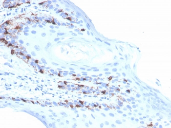 IHC staining of FFPE human skin with recombinant Melan-A antibody (clone rMLANA/4576). HIER: boil tissue sections in pH 9 10mM Tris with 1mM EDTA for 20 min and allow to cool before testing.~
