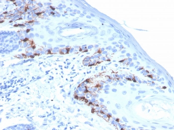 IHC staining of FFPE human skin with recombin