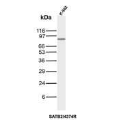 SATB2 Antibody Human K562 Cell Line WB. Western blot analysis of human K562 cell lysate using recombinant rabbit monoclonal SATB2 antibody clone SATB2/4374R. A prominent band is detected at approximately 85 kDa, consistent with the expected molecular weight of Special AT-rich sequence-binding protein 2 / SATB2, a nuclear chromatin organizer involved in colorectal lineage specification and regulation of differentiation-associated transcriptional programs.