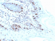 IHC staining of FFPE human skin with recombinant MART-1 antibody (clone MLANA/4475R). HIER: boil tissue sections in pH 9 10mM Tris with 1mM EDTA for 20 min and allow to cool before testing.