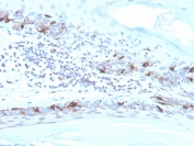 IHC staining of FFPE human skin with recombinant MART-1 antibody (clone MLANA/4475R). HIER: boil tissue sections in pH 9 10mM Tris with 1mM EDTA for 20 min and allow to cool before testing.